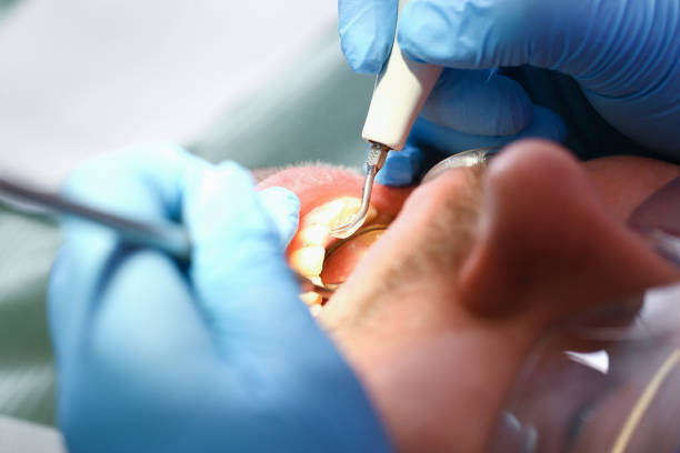 Best Pediatric Emergency Dentist in Maywood, CA